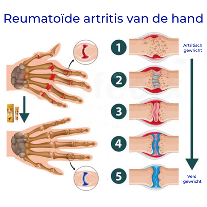 Propolis Professionele Behandelingsgel voor botten en gewrichtspijn | 1+1 GRATIS!