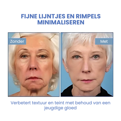 SkinLift™ | Botox Gezicht Serum